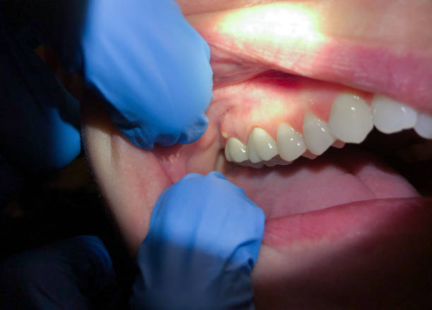 Best After-Hours Dental Care in Hamburg, AR