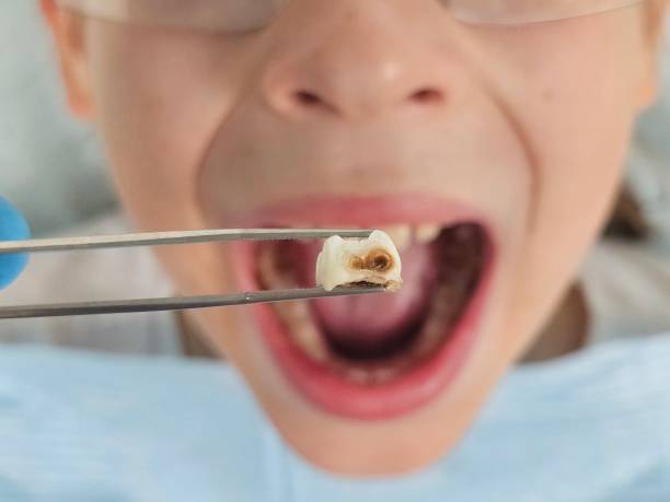 Best Emergency Root Canal Therapy in Hamburg, AR